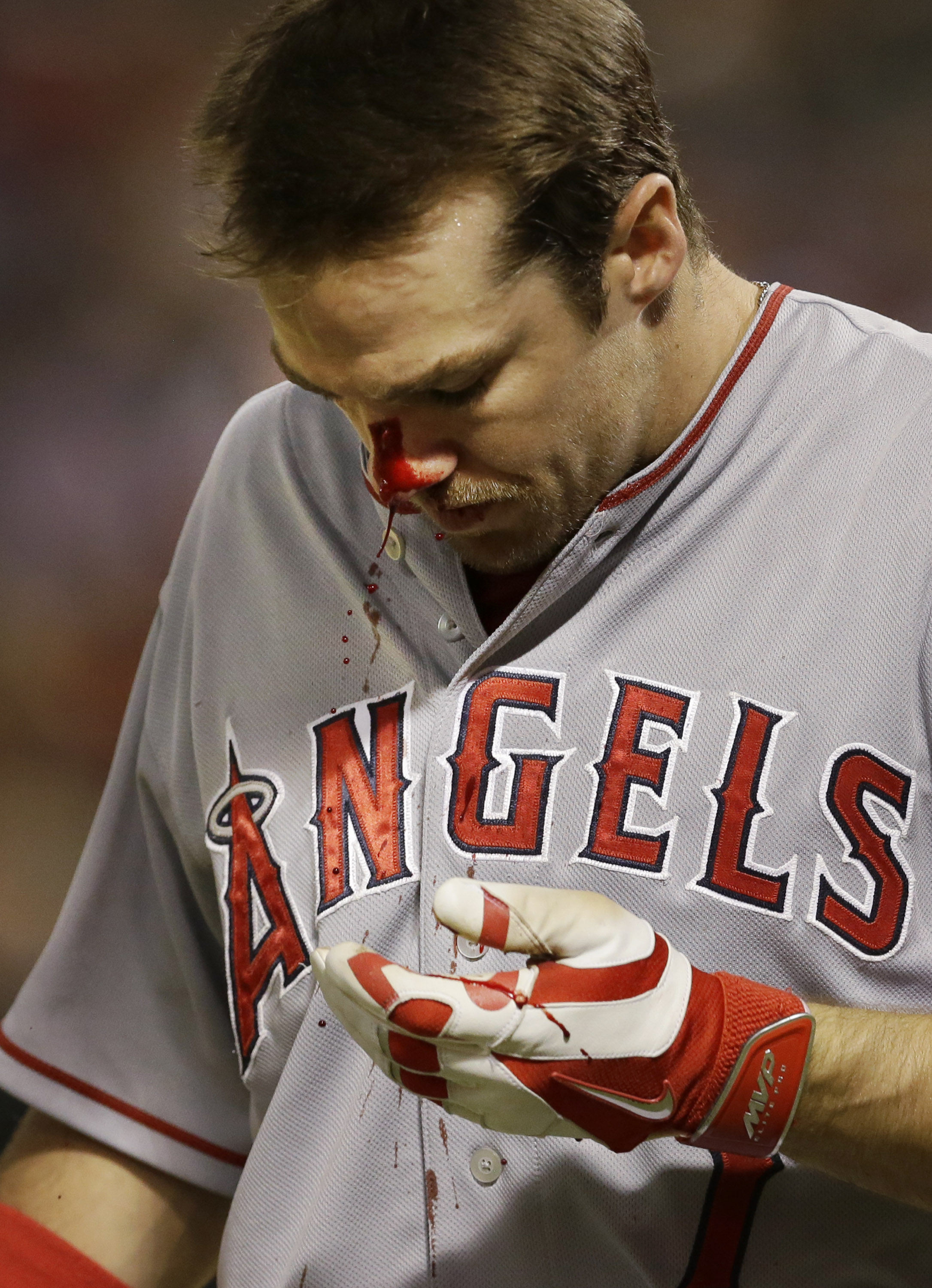 Angels put Cowgill on DL with broken nose, thumb
