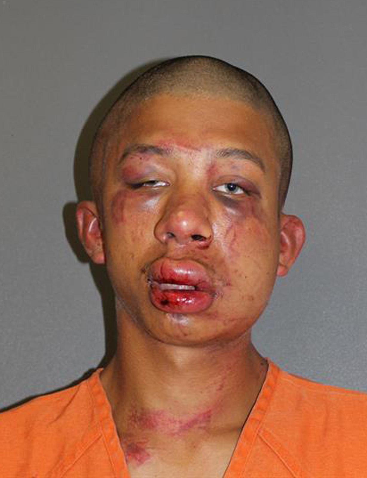 Police: Fla father beats accused child abuser
