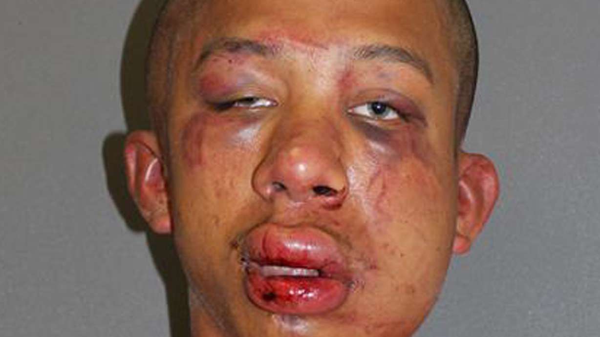 Police: Fla father beats accused child abuser