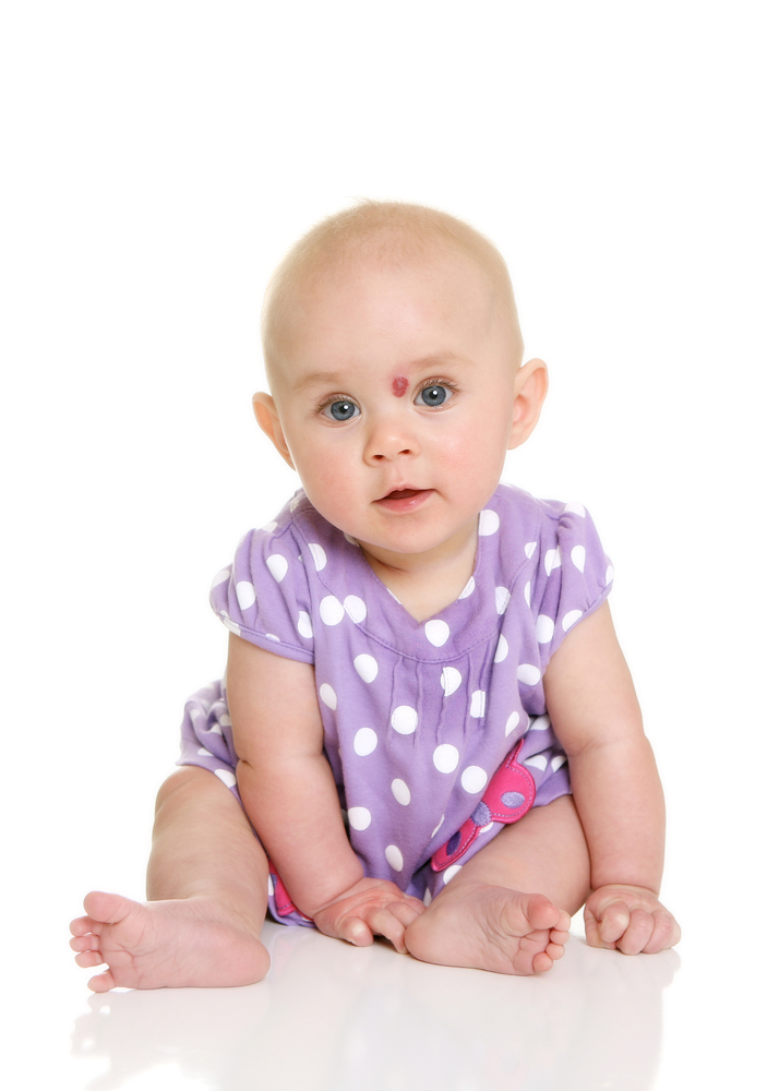 Dealing with infantile hemangioma? Here's what to do