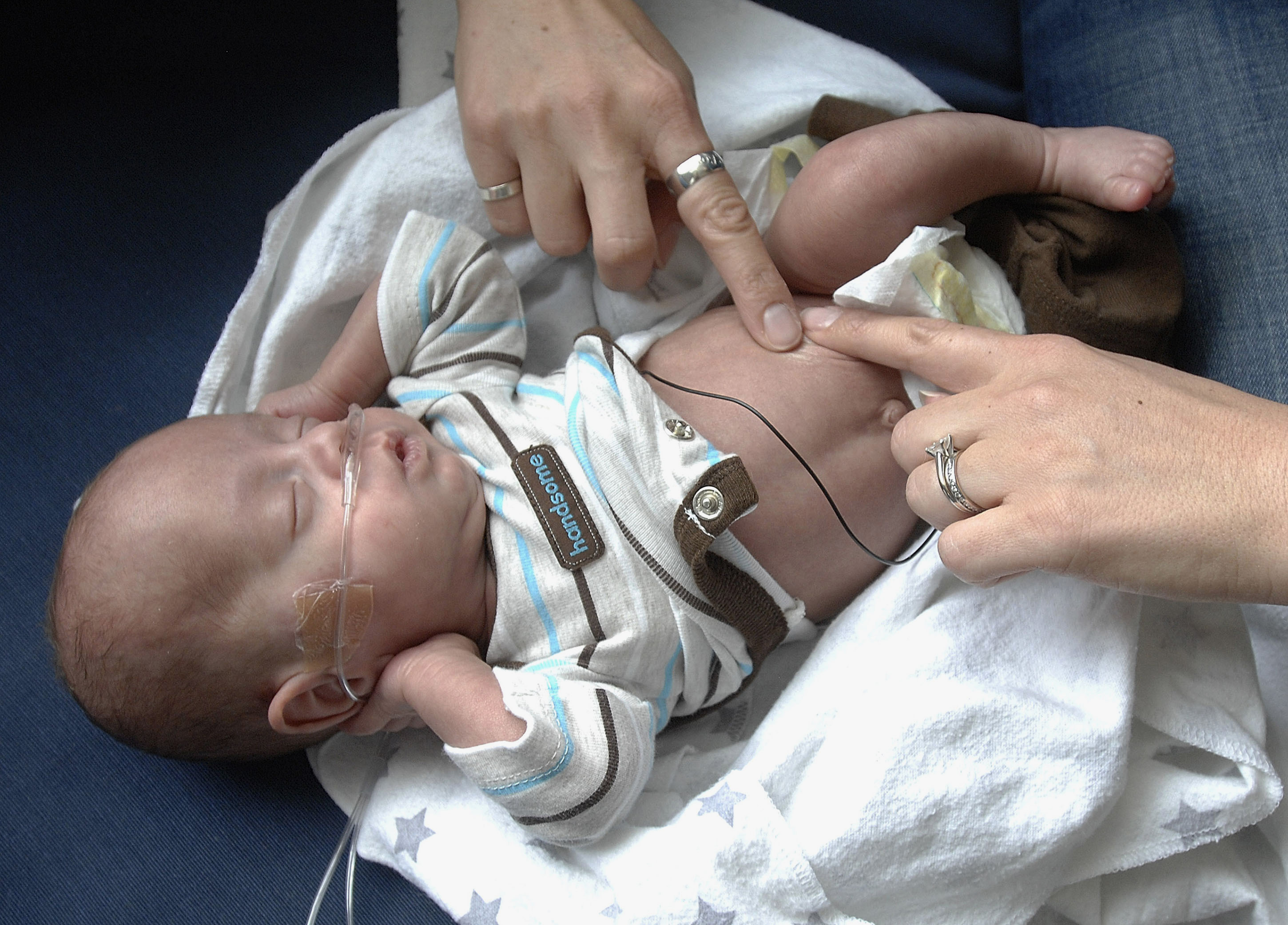 Baby born at 23 weeks defies odds, comes home