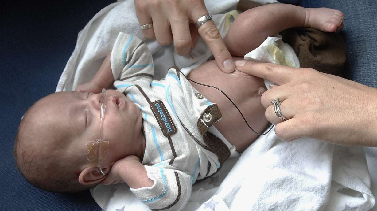 Baby born at 23 weeks defies odds, comes home
