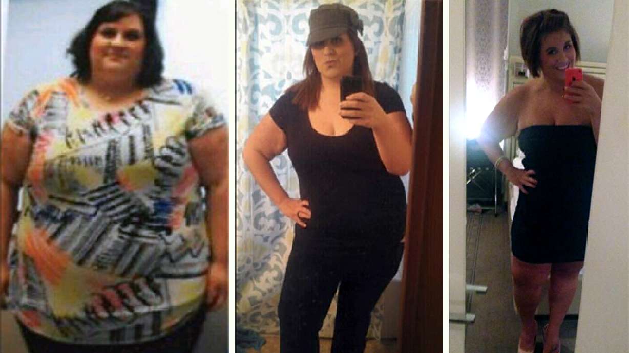 What they never tell you about losing a lot of weight