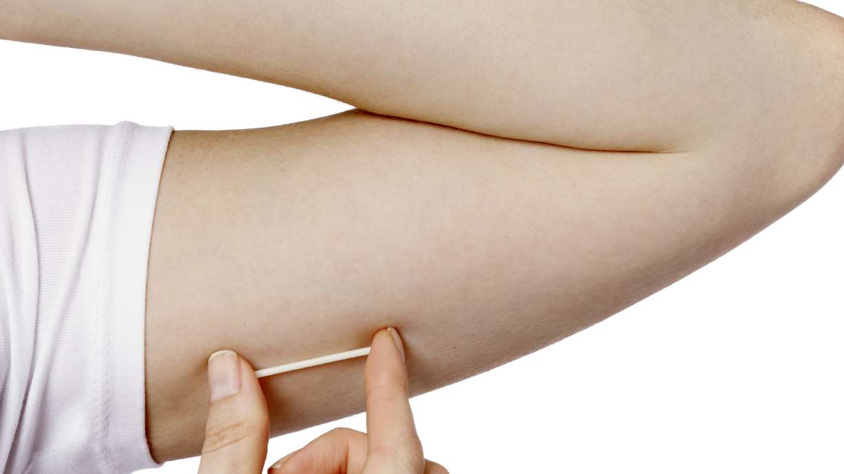 Pediatricians urge IUDs or implants for teen girls