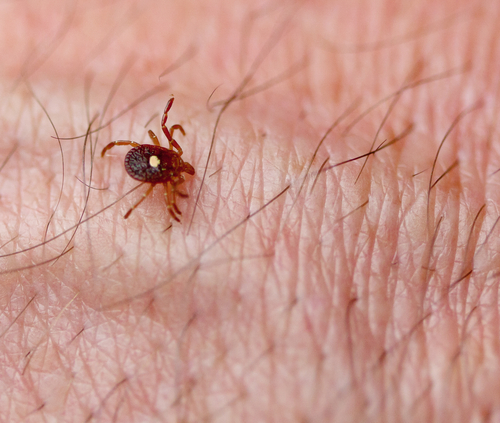 Can tick bites force people to become vegetarians?