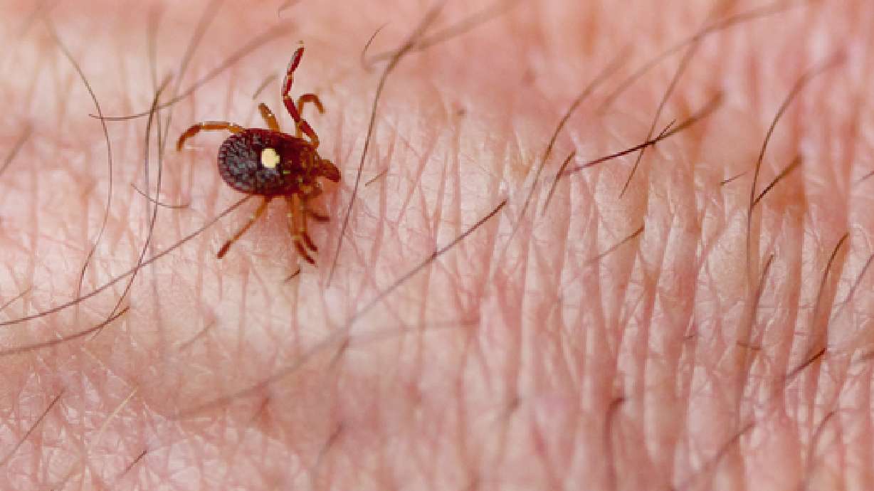 Can tick bites force people to become vegetarians?