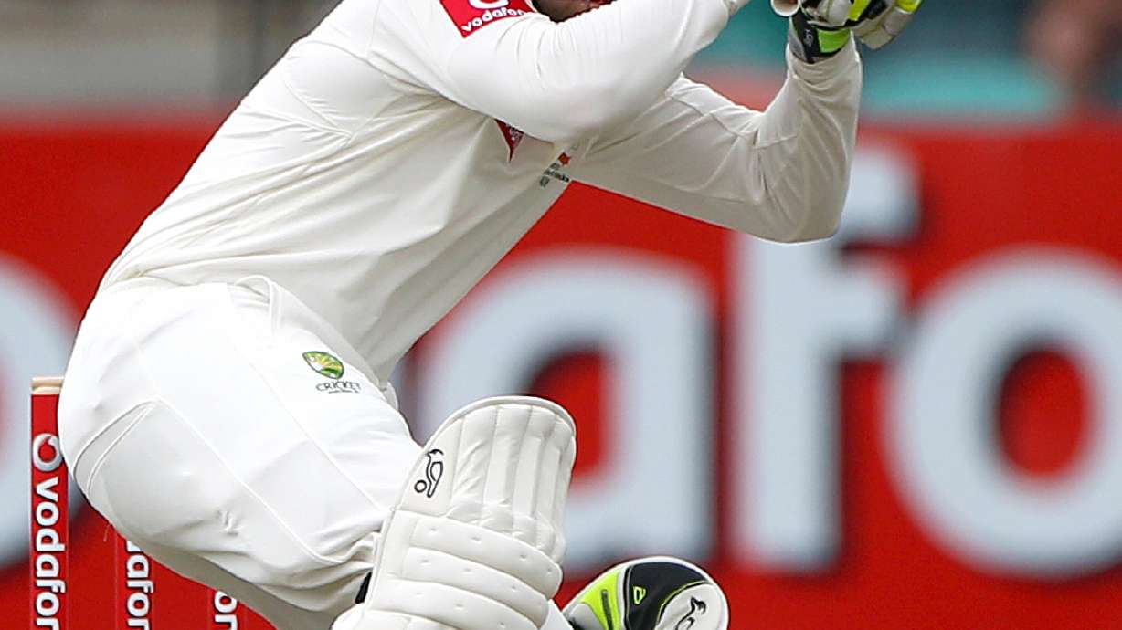 Cricketer critical after he's hit in head by ball