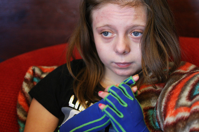 Young plane crash survivor reunites with friends