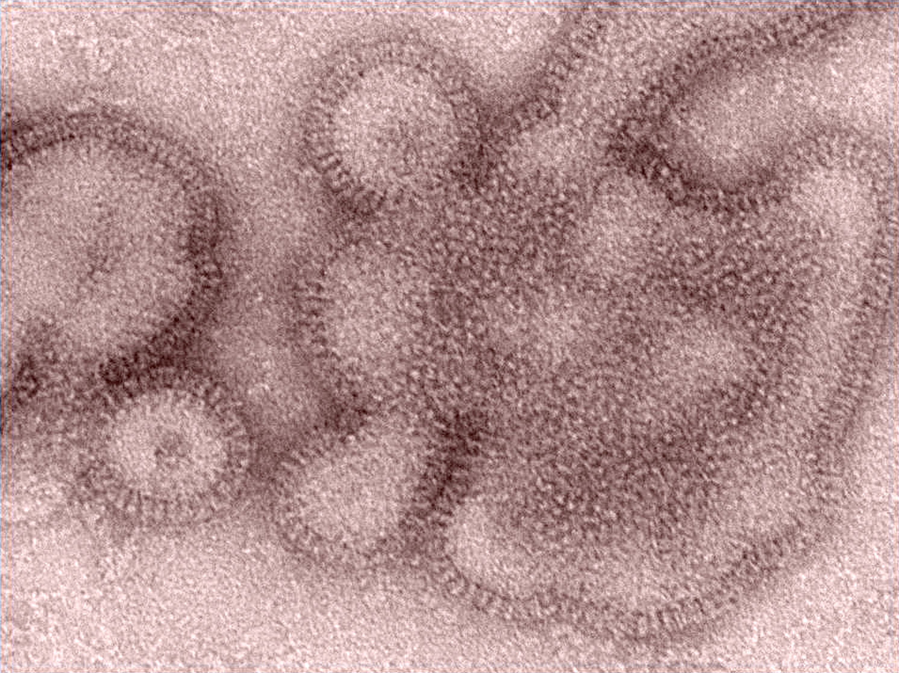 Flu vaccine not working well; only 23 percent effective