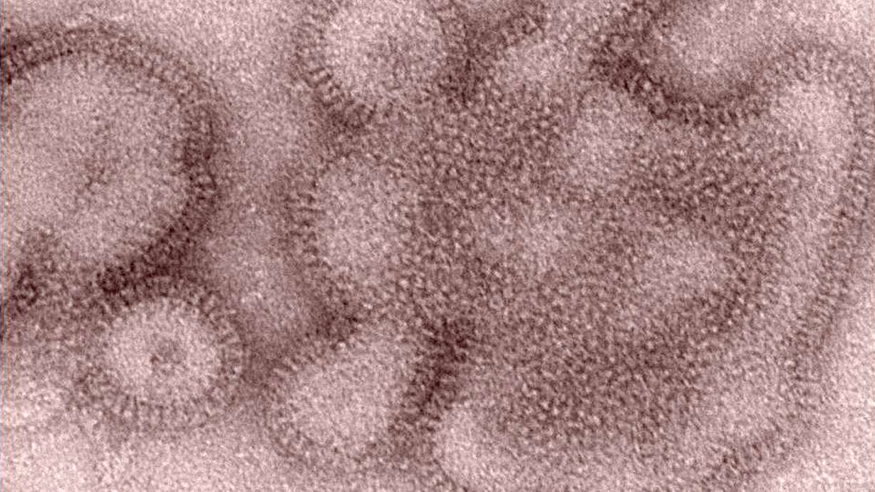 Flu vaccine not working well; only 23 percent effective