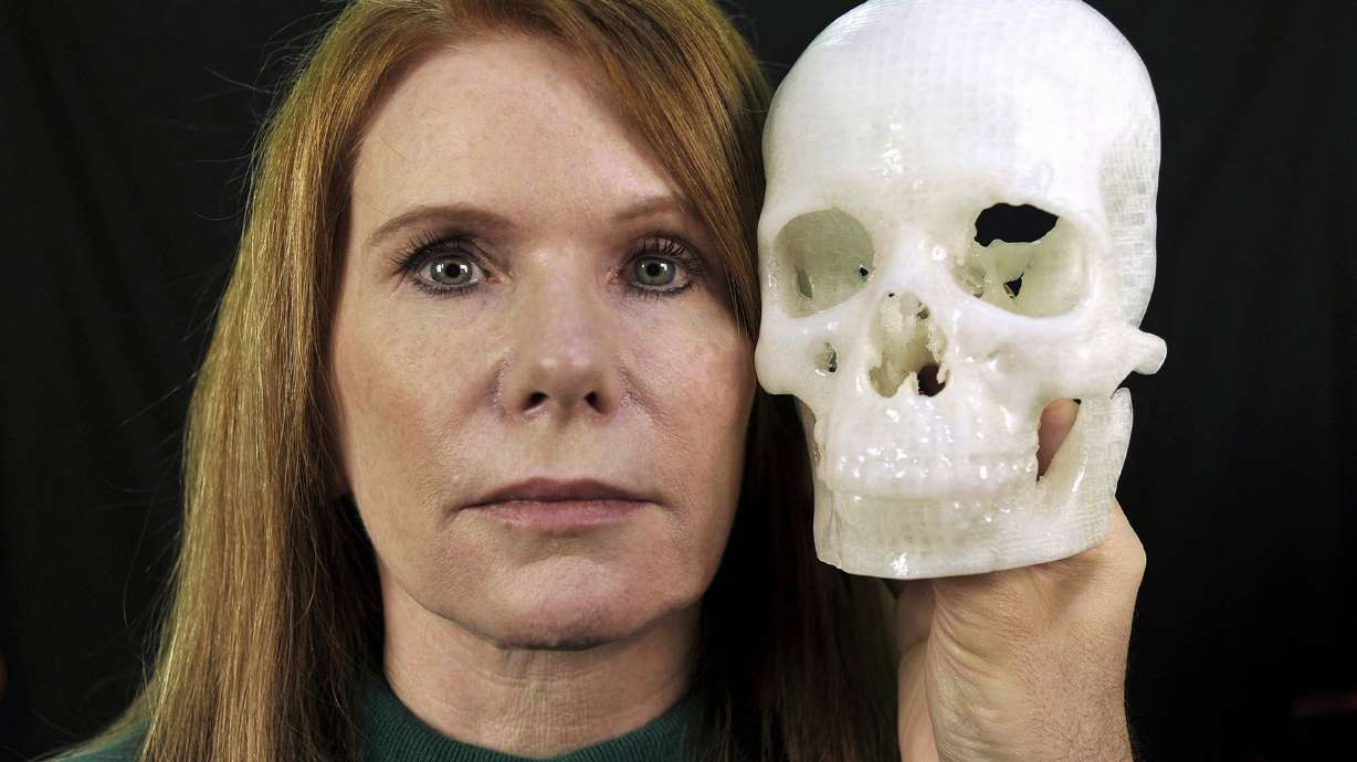 Hard search for less invasive brain surgery leads to eyelid