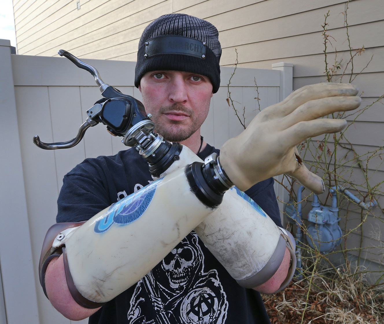 U. to develop technology for bionic hand controlled by thoughts, gives feeling