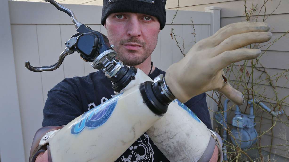 U. to develop technology for bionic hand controlled by thoughts, gives feeling
