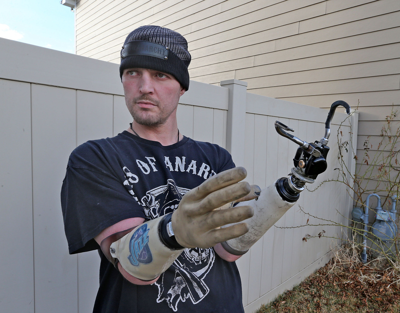 Matthew Beckstead, 36, lost his hands in an electrical accident when he was 19 and has recently participated in the study of the Utah Slanted Electrode Array, Monday, Feb. 9, 2015, in North Salt Lake City. (Photo: Tom Smart, Deseret News)