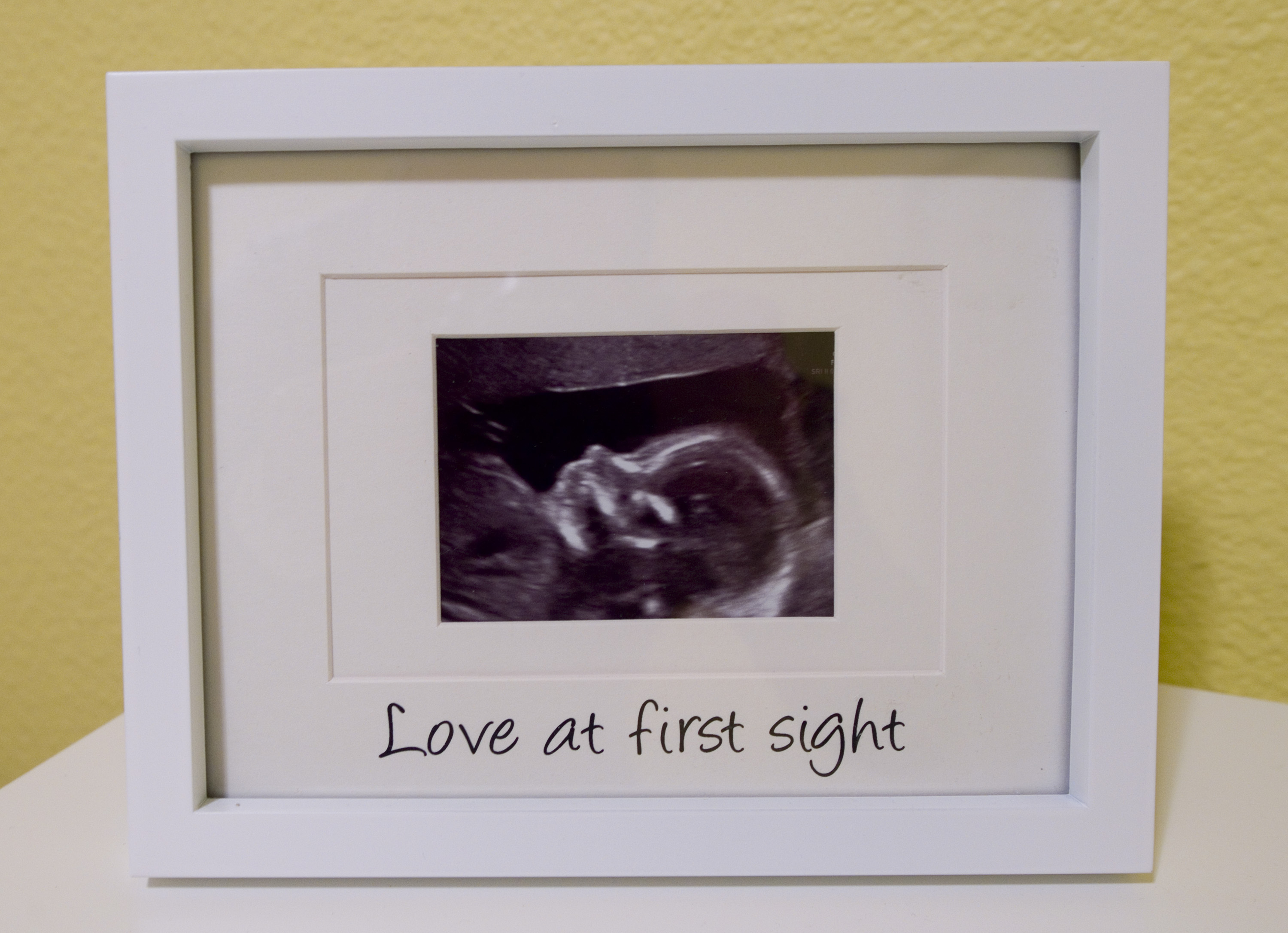 Greenwood parents prepare for baby's birth, heart defect