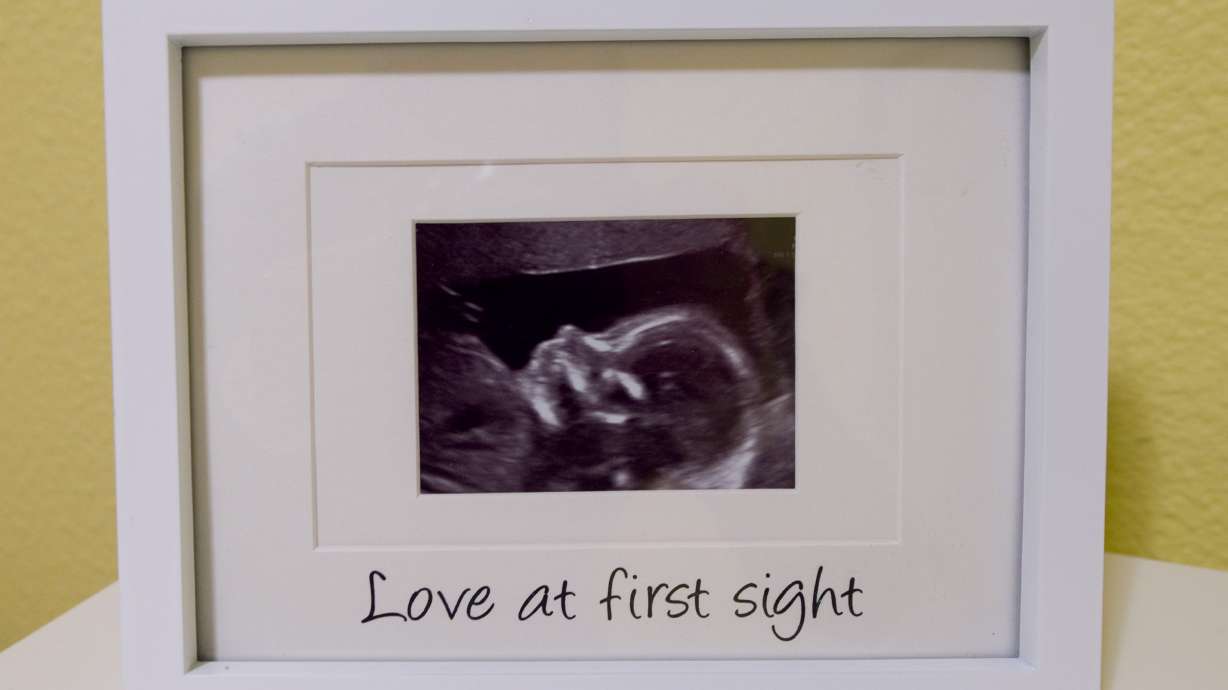 Greenwood parents prepare for baby's birth, heart defect