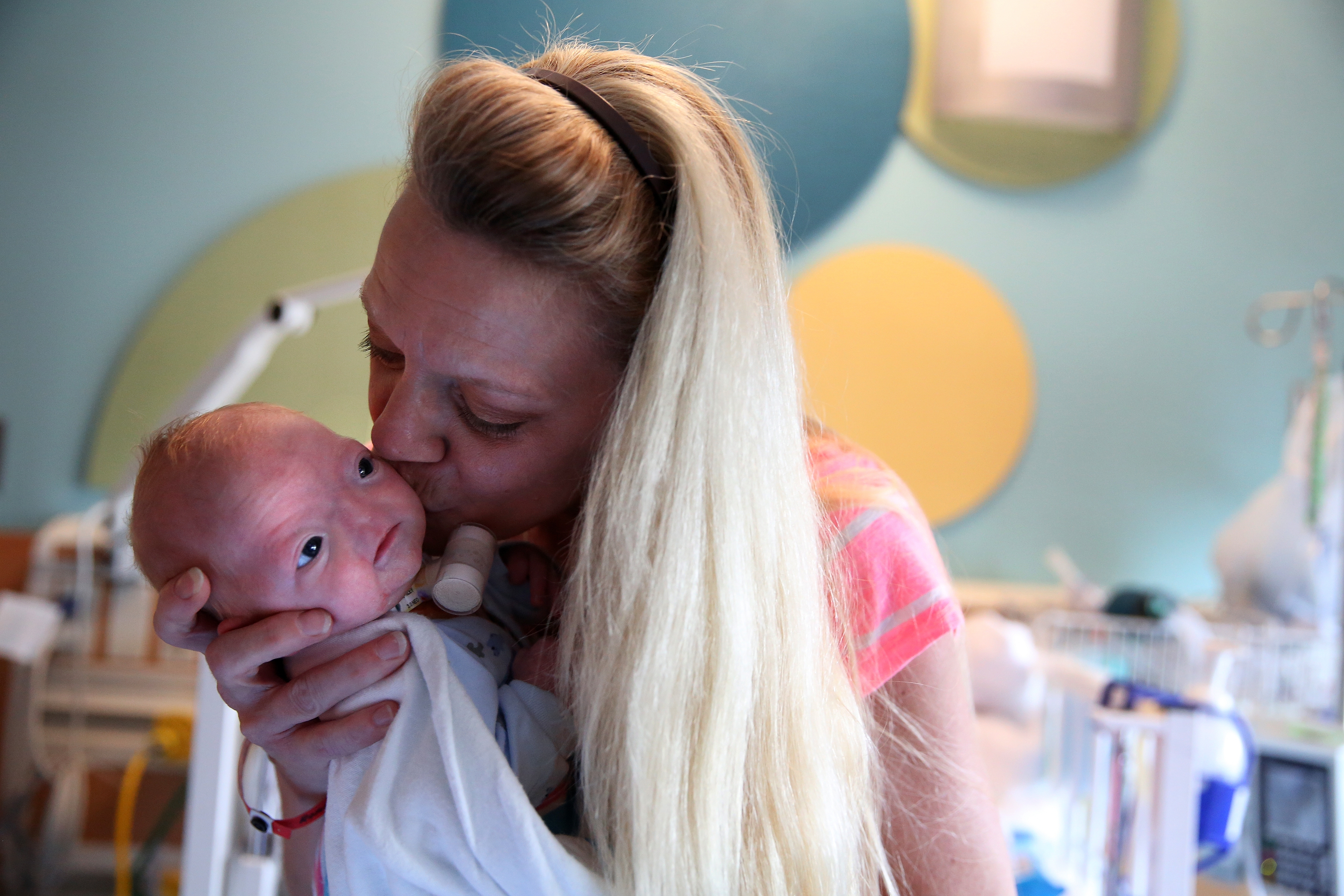 Alabama mom: Baby born without nose 'perfect the way he is'