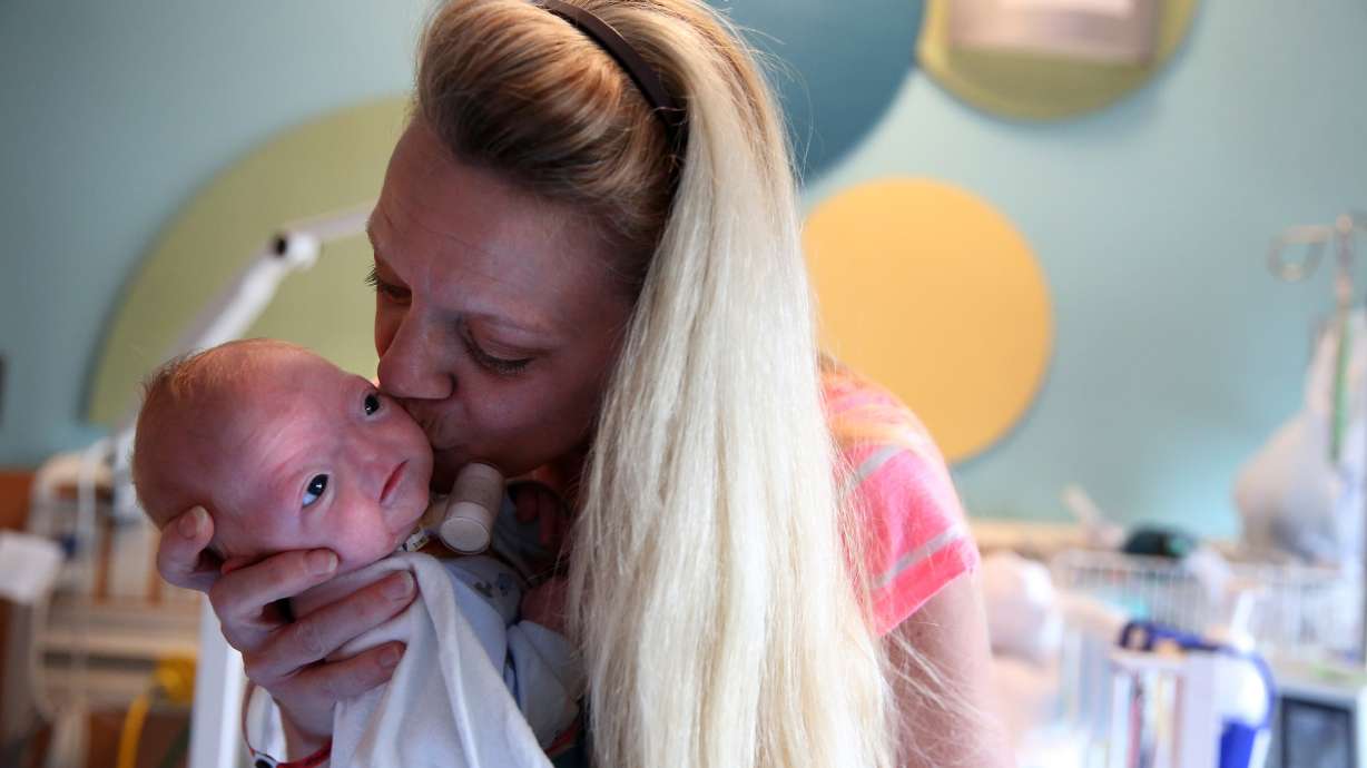 Alabama mom: Baby born without nose 'perfect the way he is'