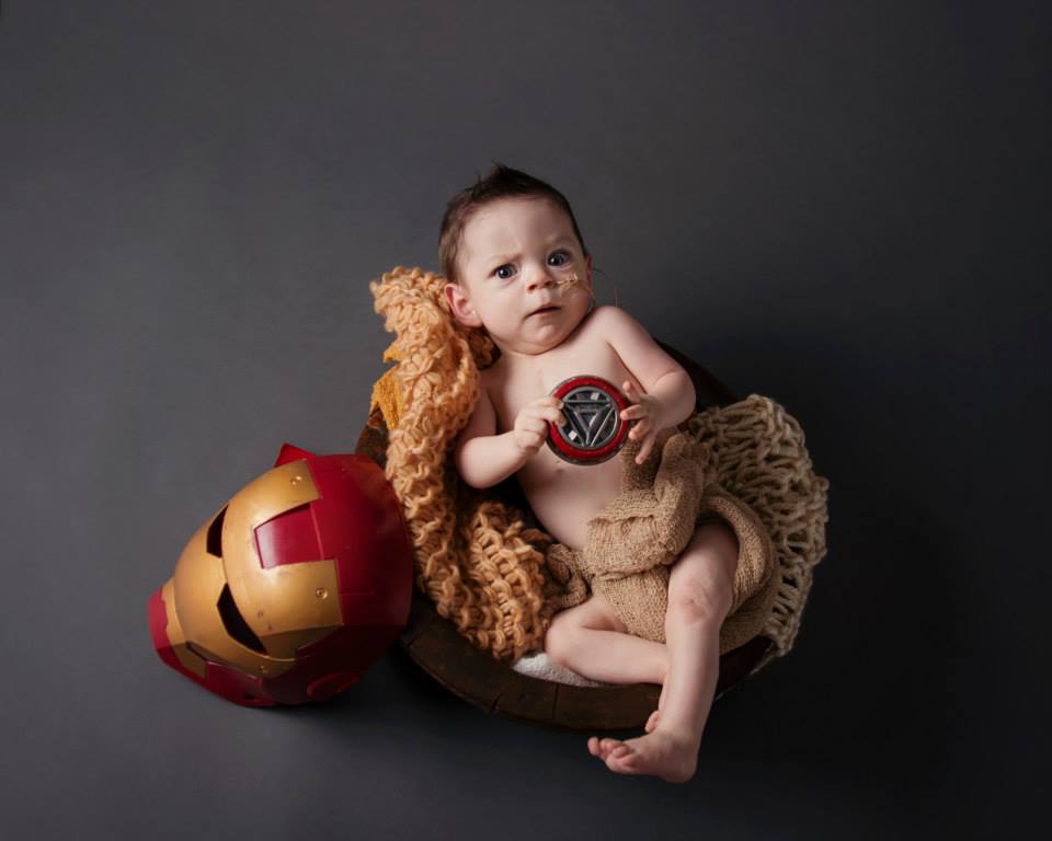 Local fundraiser to benefit 10-month-old 'Baby Iron Man'