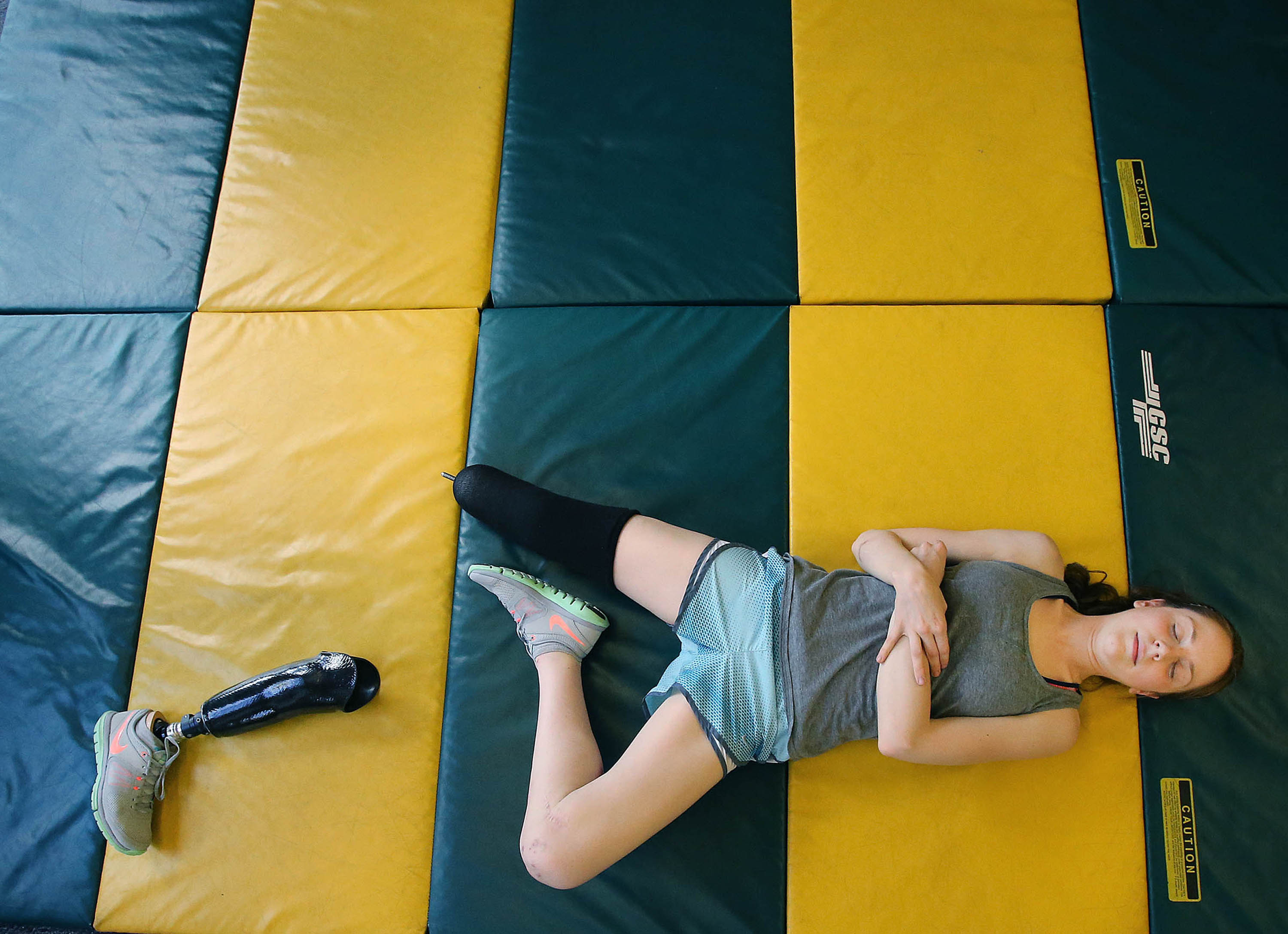 Music career ambition survives student's amputation