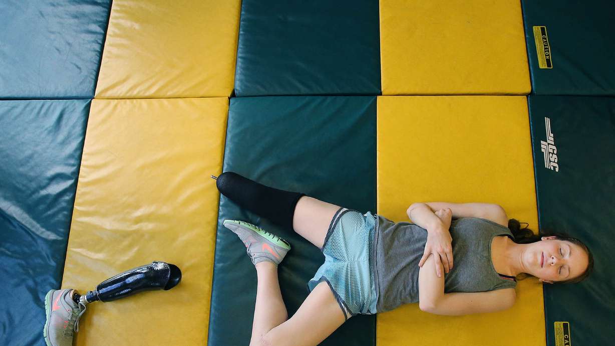 Music career ambition survives student's amputation