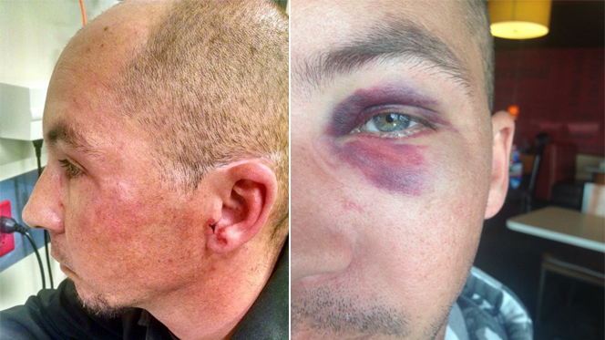 Officer to undergo surgery after assault during domestic call