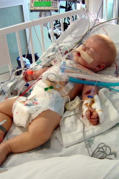 Alex Homer was born with half a heart. Finally at age 7, he received a heart transplant. (Photo: Brynn Homer)