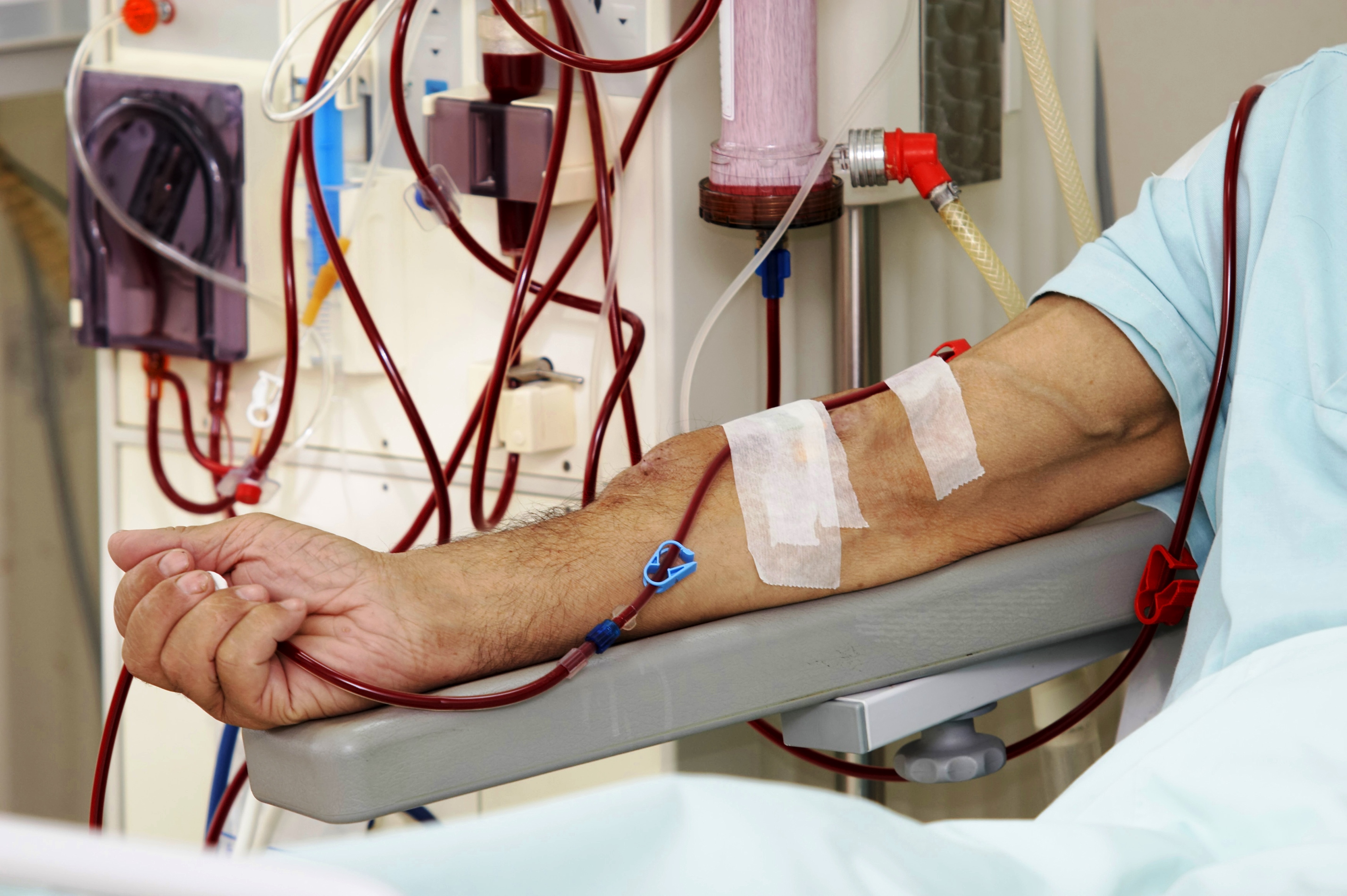 Making the dialysis decision: What you need to know