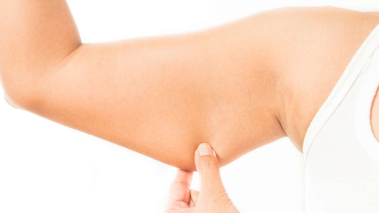 3D printers could soon make human skin