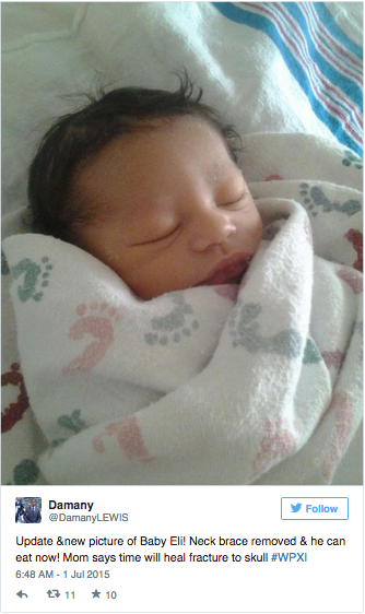 Enfermera deja caer al suelo a recién nacido provocándole una fractura de cráneo 