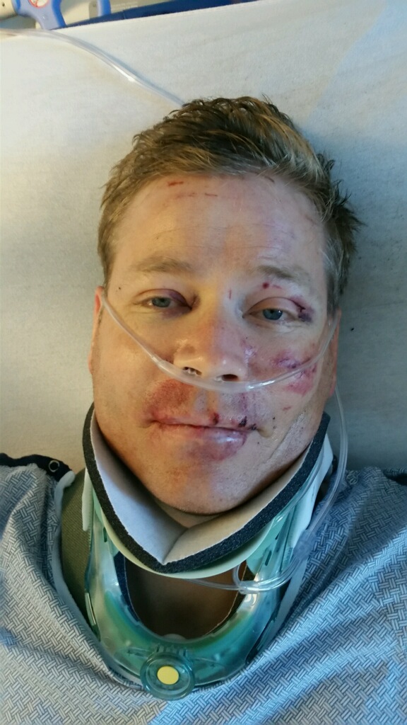 Peter Lindhardt has received eight surgeries after sustaining a compound fracture on his leg among several other injuries. (Photo: Courtesy of the Lindhardt family)