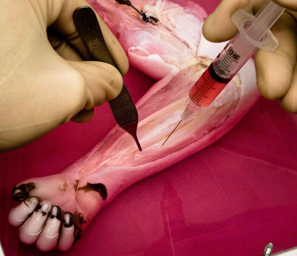 In a U.S. laboratory, a monkey arm is stripped down as far as its individual cells. All that's left behind is a bare, frail scaffold. The process involves removing all cells from the limb using fluids and detergents. Cells are then regrown and replaced using human progenitor cells, which can develop into blood, nerve or muscle cells. (Photo: Massachusetts General Hospital Center for Regenerative Medicine)