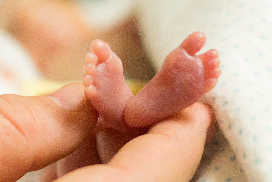 Photo of premature twins spreads hope, sparks controversy