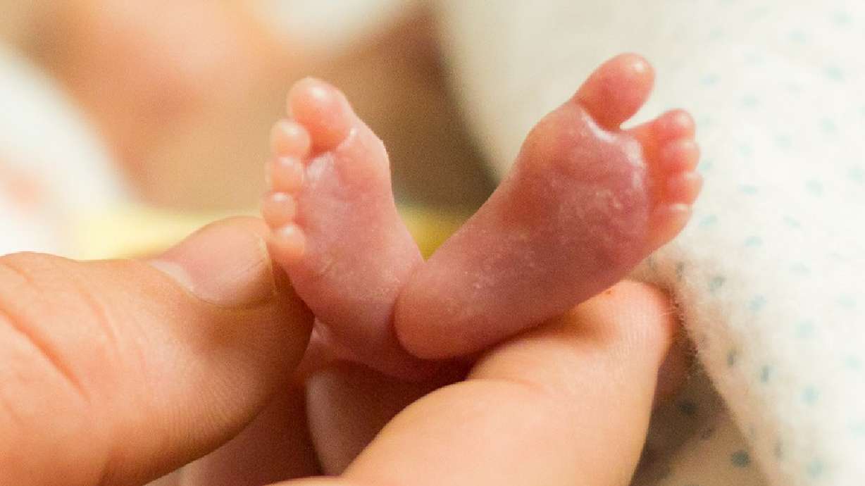 Photo of premature twins spreads hope, sparks controversy