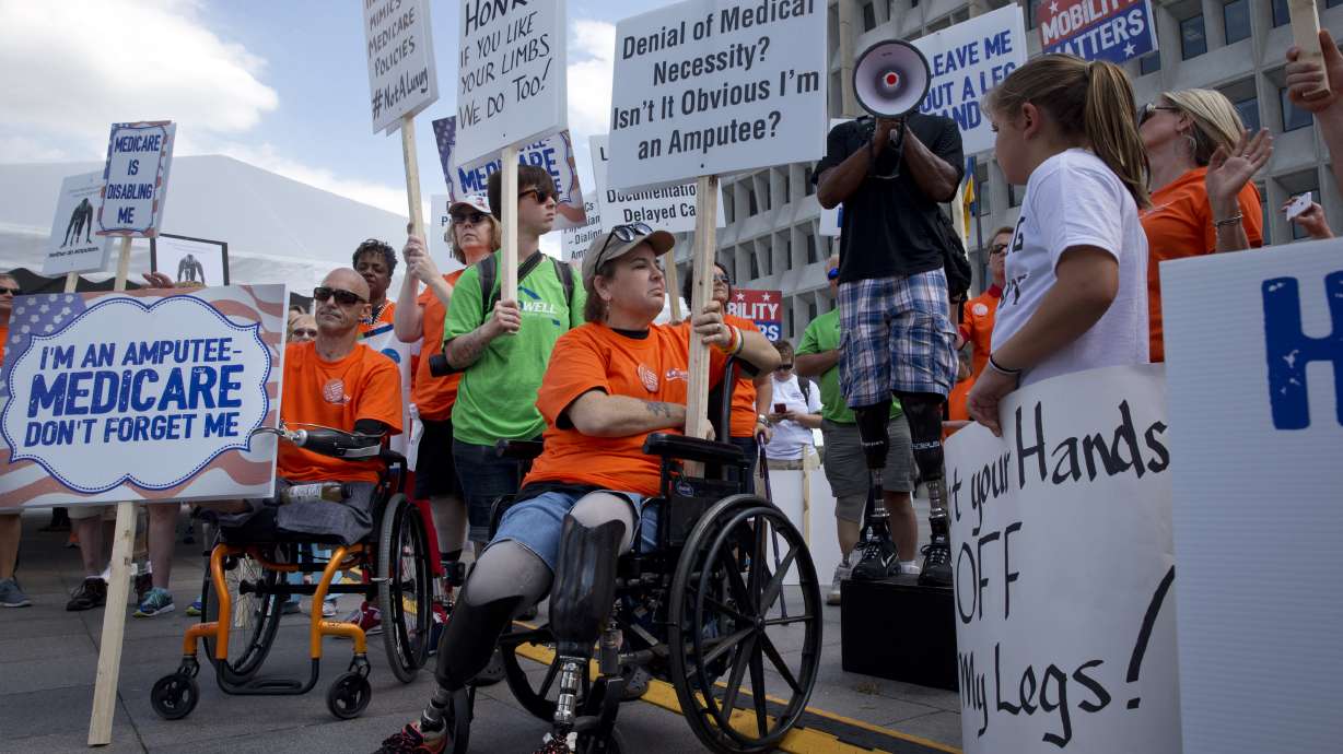 Amputees decry Medicare payment overhaul for artificial feet