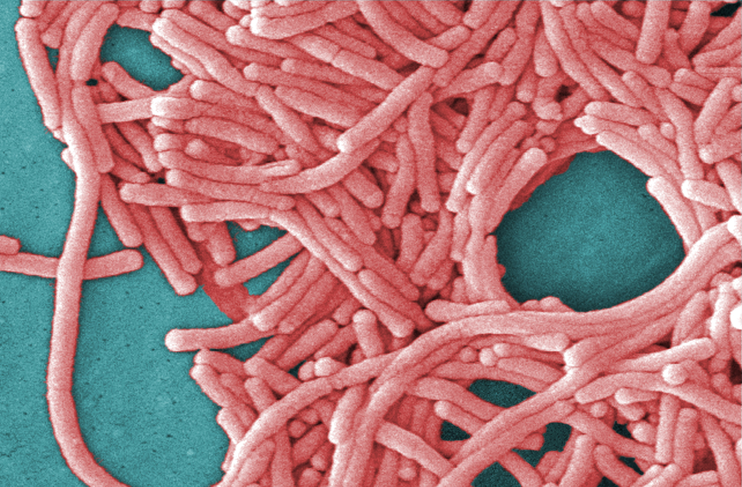Legionnaires' outbreaks not unusual in summer & early fall