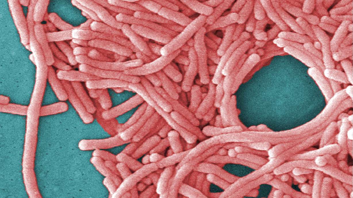 Legionnaires' outbreaks not unusual in summer & early fall