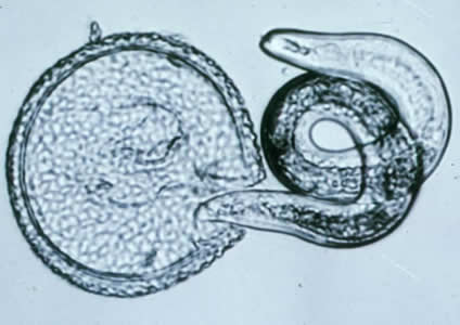 T. canis larva hatching (Photo: CDC)