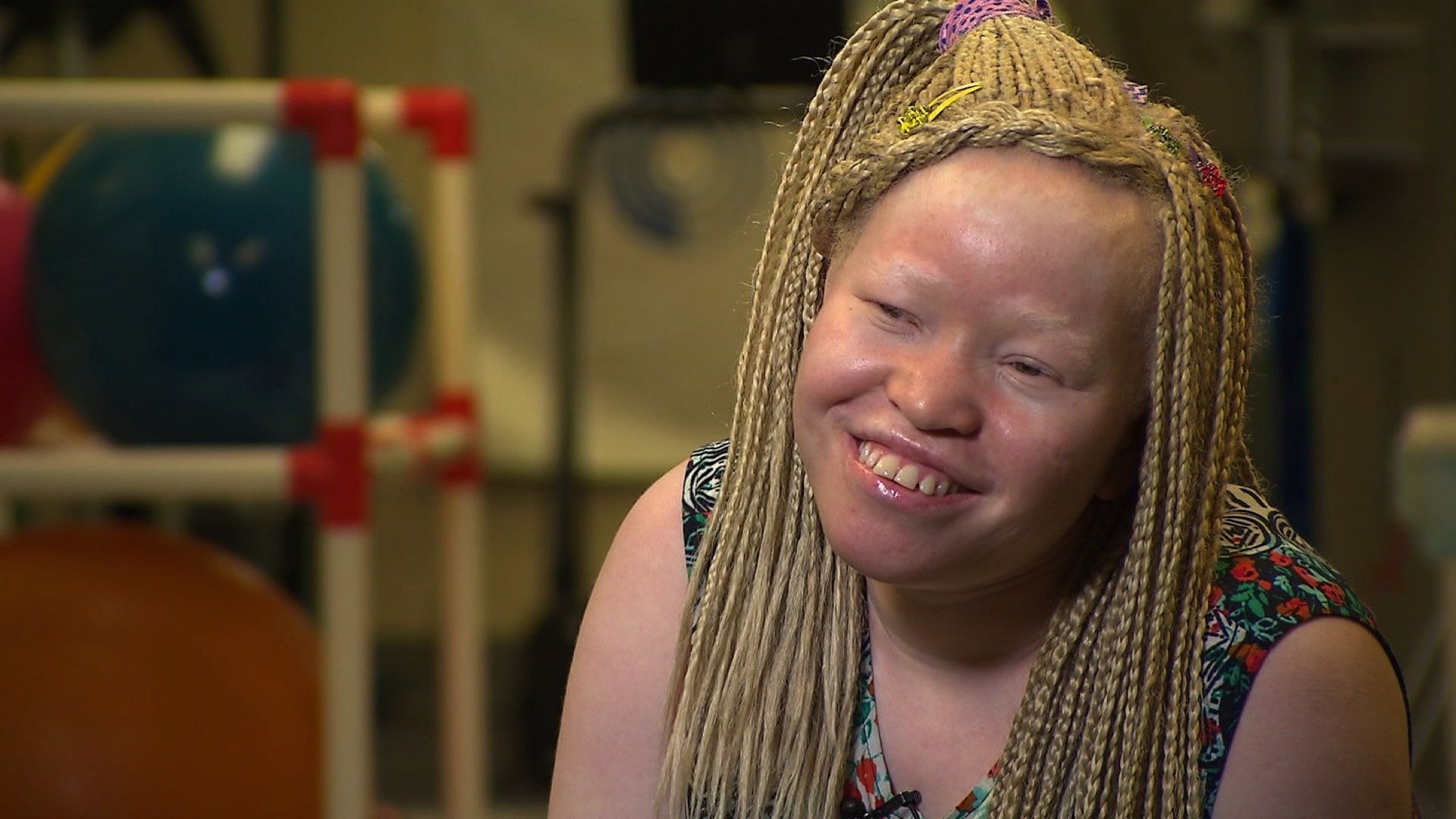Albino teen attacked for body parts gets reason to smile again