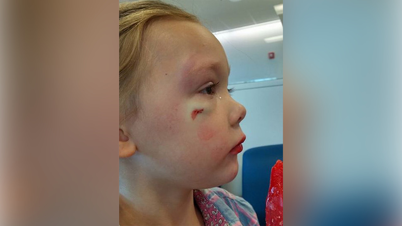 Mom to hospital worker: Don't tell my daughter 'hitting is flirting'