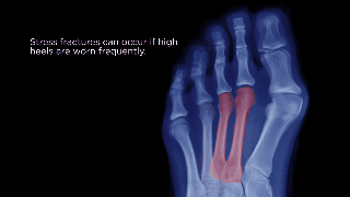 Photo credit: Buzzfeed video