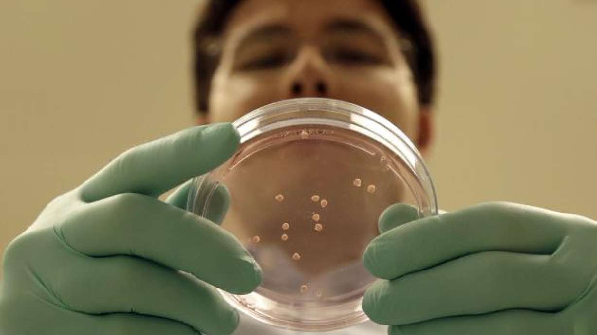 Cultivan partes de cerebro humano para estudios