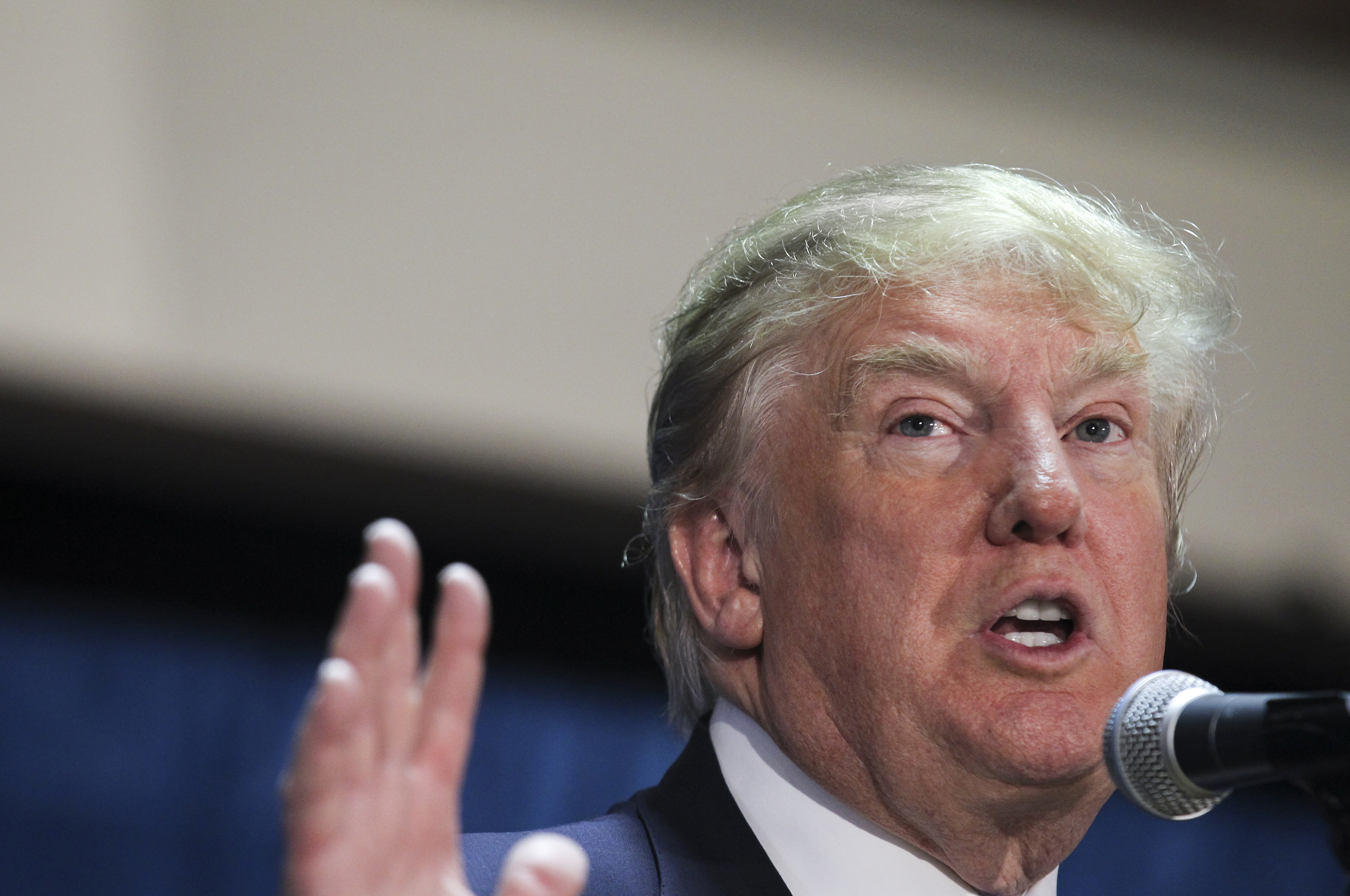 Trump says Carson's 'pathological temper' can't be cured