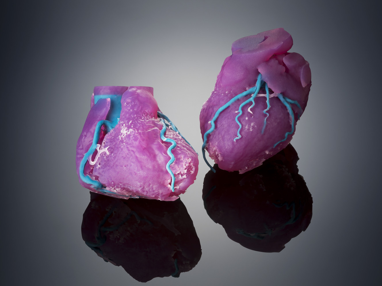3D printed hearts, a perfect replica of a patient. (Photo: Courtesy of Stratasys)