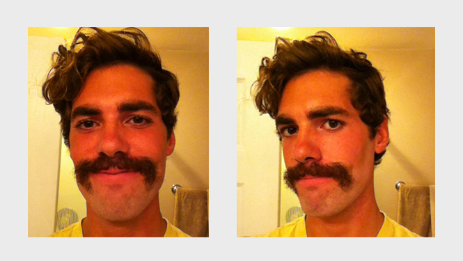 Matthew Neilson | Turns out that city boys in New York pay a ton of money to graft hair from their heads onto their faces to keep up with those whom nature endowed with true greatness.