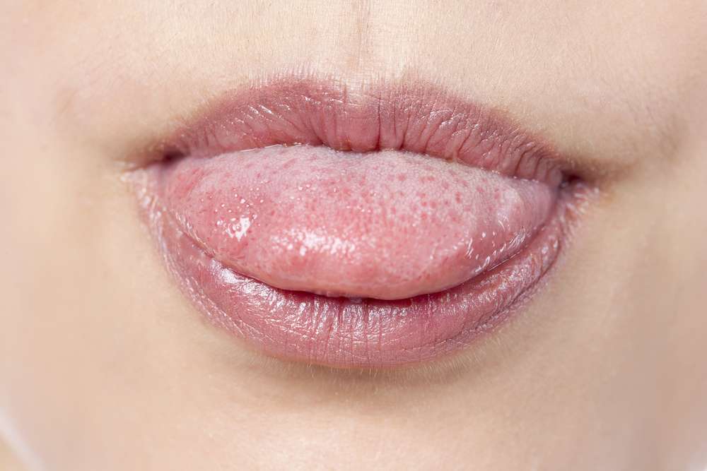 The bumps and ridges on your tongue make it unique from any other. (Photo: Dan Kosmayer/Shutterstock)