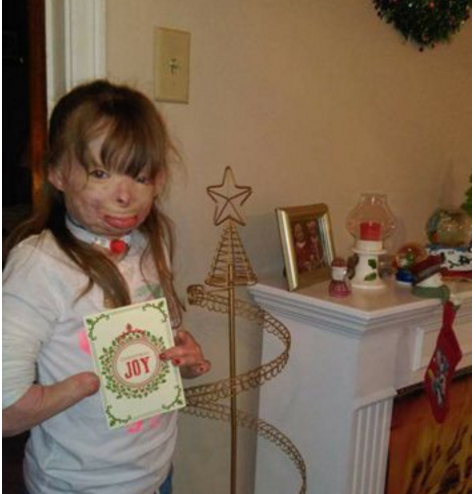 Niña sobrevive incendio que mató a su familia, se convierte en un milagro de Navidad