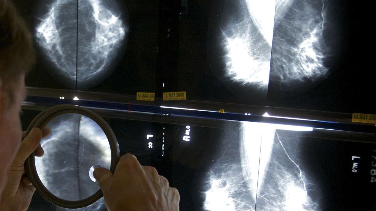 Task force: Mammograms an option at 40, do more good at 50