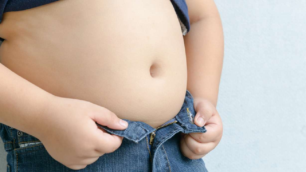 Childhood obesity panel: 40 million kids under 5 overweight