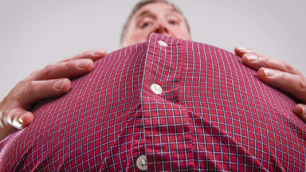 When medical weight loss is a solution for you